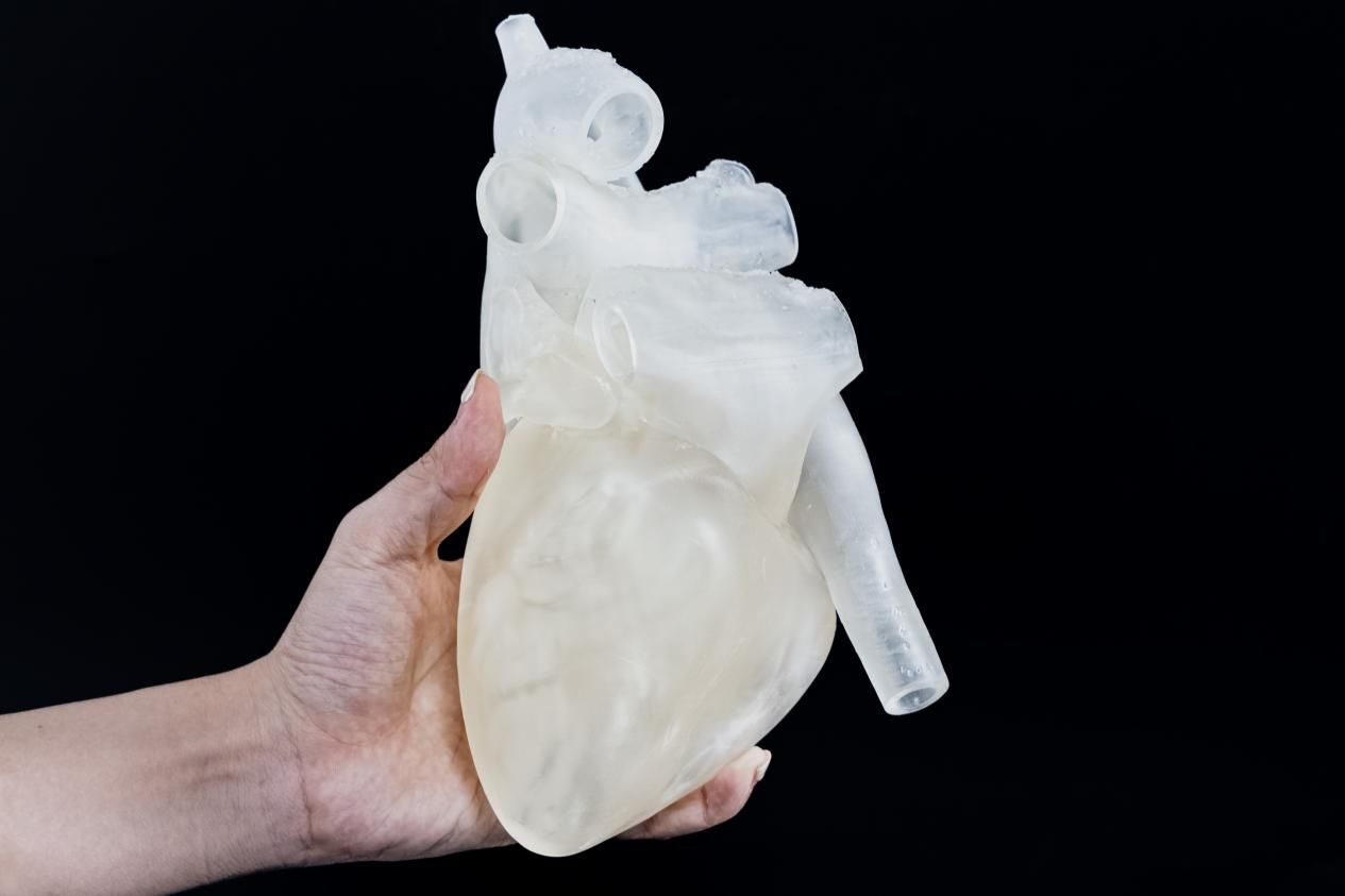 3d打印技术在医疗领域的应用之骨科应用