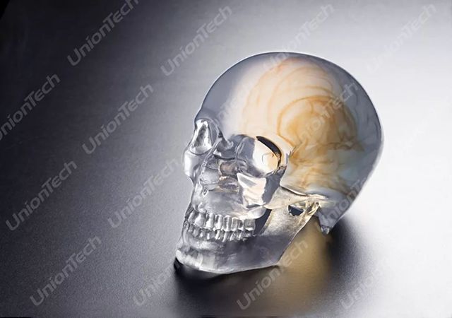 世界杯官网答疑室 | 3D打印,我劝你在医疗行业别这么“嚣张”