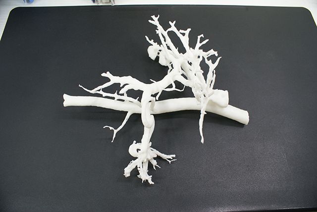 世界杯官网答疑室 | 3D打印,我劝你在医疗行业别这么“嚣张”