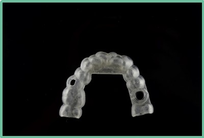 “以科技破局,以数字化赋能”——世界杯官网与精瓷义齿共创齿科3D打印医疗新未来01 “以科技破局,以数字化赋能”——世界杯官网与精瓷义齿共创齿科3D打印医疗新未来01
