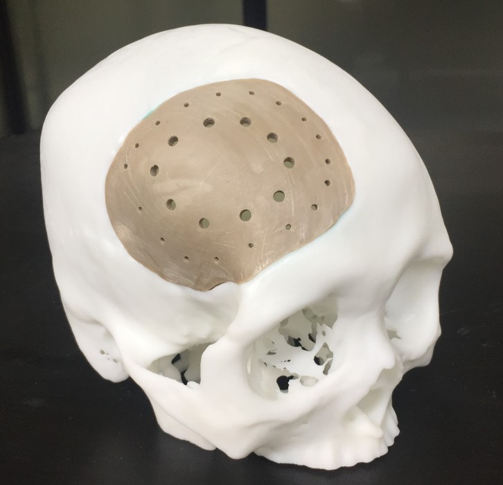 3D打印应用
