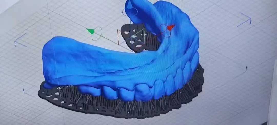 数字化3D打印技术